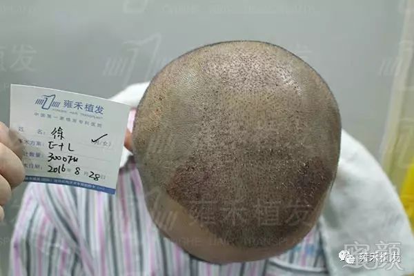 https://img.miyanlife.com/mnt/timg/180415/123P210Q-8.jpg