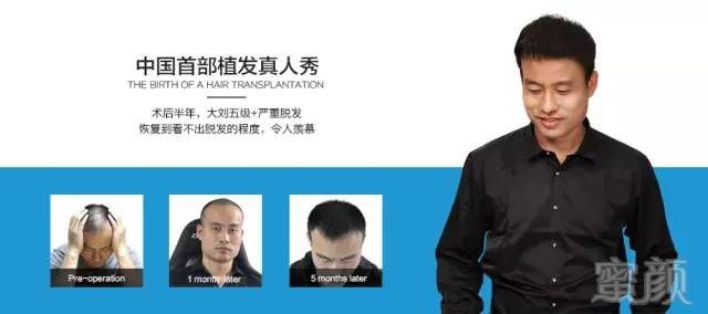 https://img.miyanlife.com/mnt/timg/180415/1250344621-4.jpg