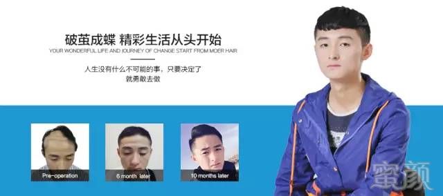 https://img.miyanlife.com/mnt/timg/180415/1250352492-5.jpg
