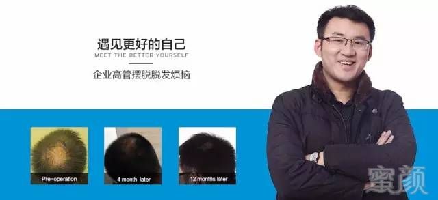 https://img.miyanlife.com/mnt/timg/180415/125035K48-8.jpg
