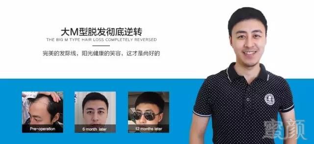 https://img.miyanlife.com/mnt/timg/180415/12503A436-9.jpg