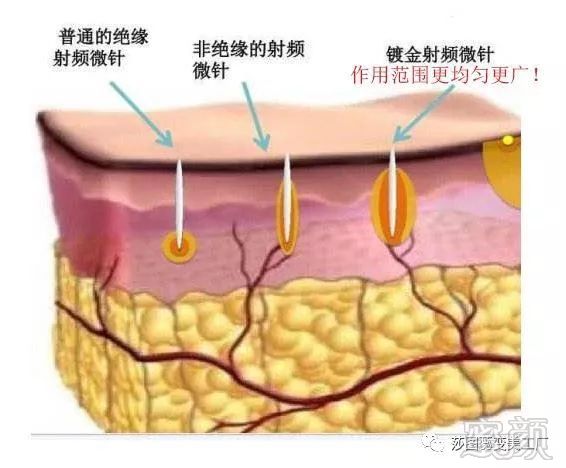 https://img.miyanlife.com/mnt/timg/180415/1302046116-6.jpg
