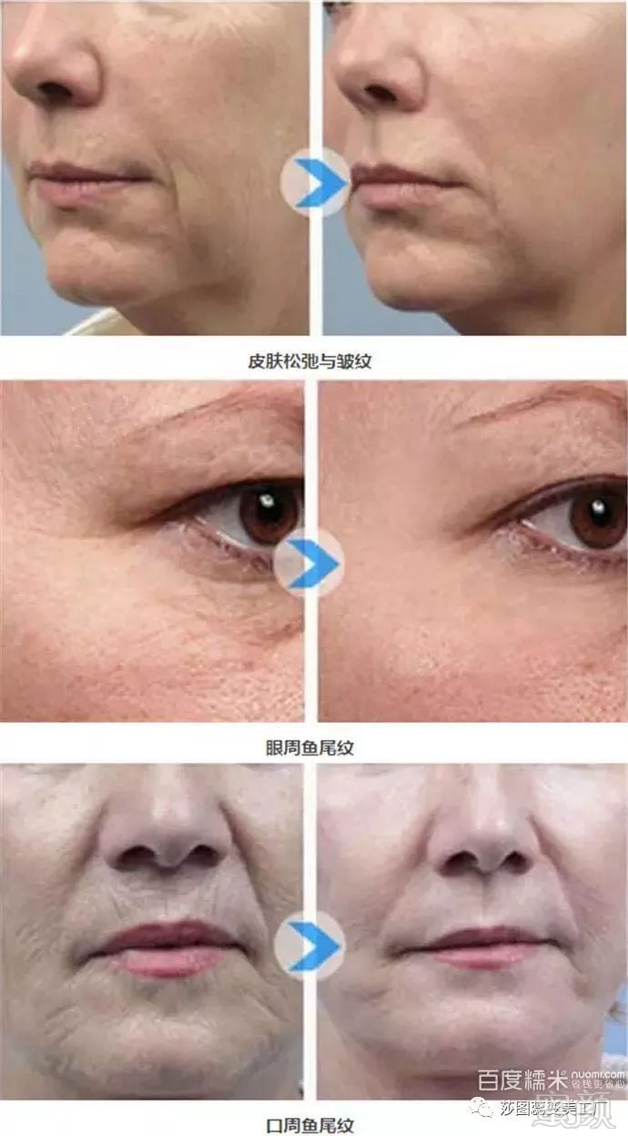 https://img.miyanlife.com/mnt/timg/180415/1302051Z6-11.jpg