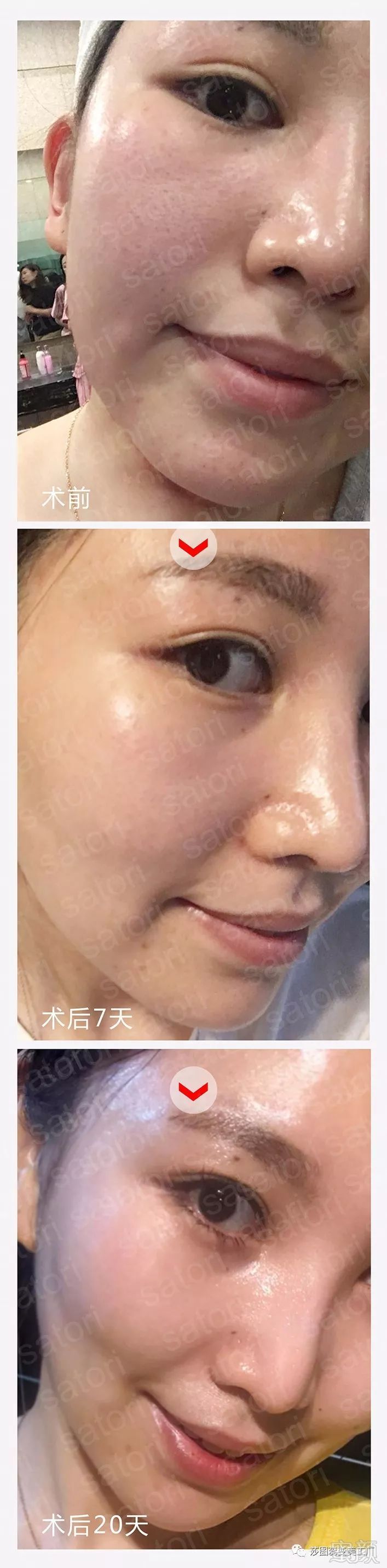https://img.miyanlife.com/mnt/timg/180415/1302061618-15.jpg