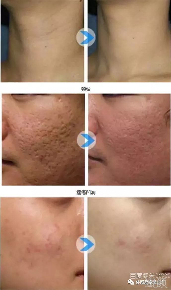 https://img.miyanlife.com/mnt/timg/180415/1302063393-12.jpg