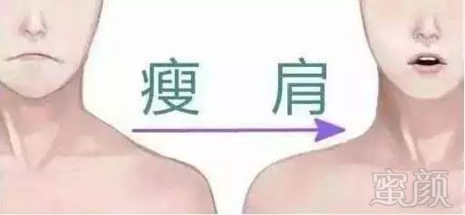 https://img.miyanlife.com/mnt/timg/180415/1302102452-3.jpg