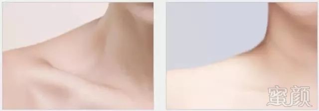 https://img.miyanlife.com/mnt/timg/180415/1302113329-5.jpg