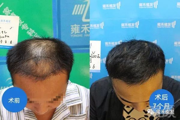 https://img.miyanlife.com/mnt/timg/180416/10512VL3-0.jpg
