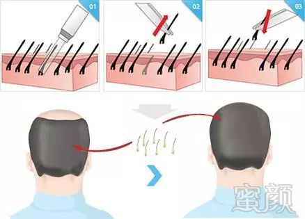 https://img.miyanlife.com/mnt/timg/180416/1100343500-1.jpg