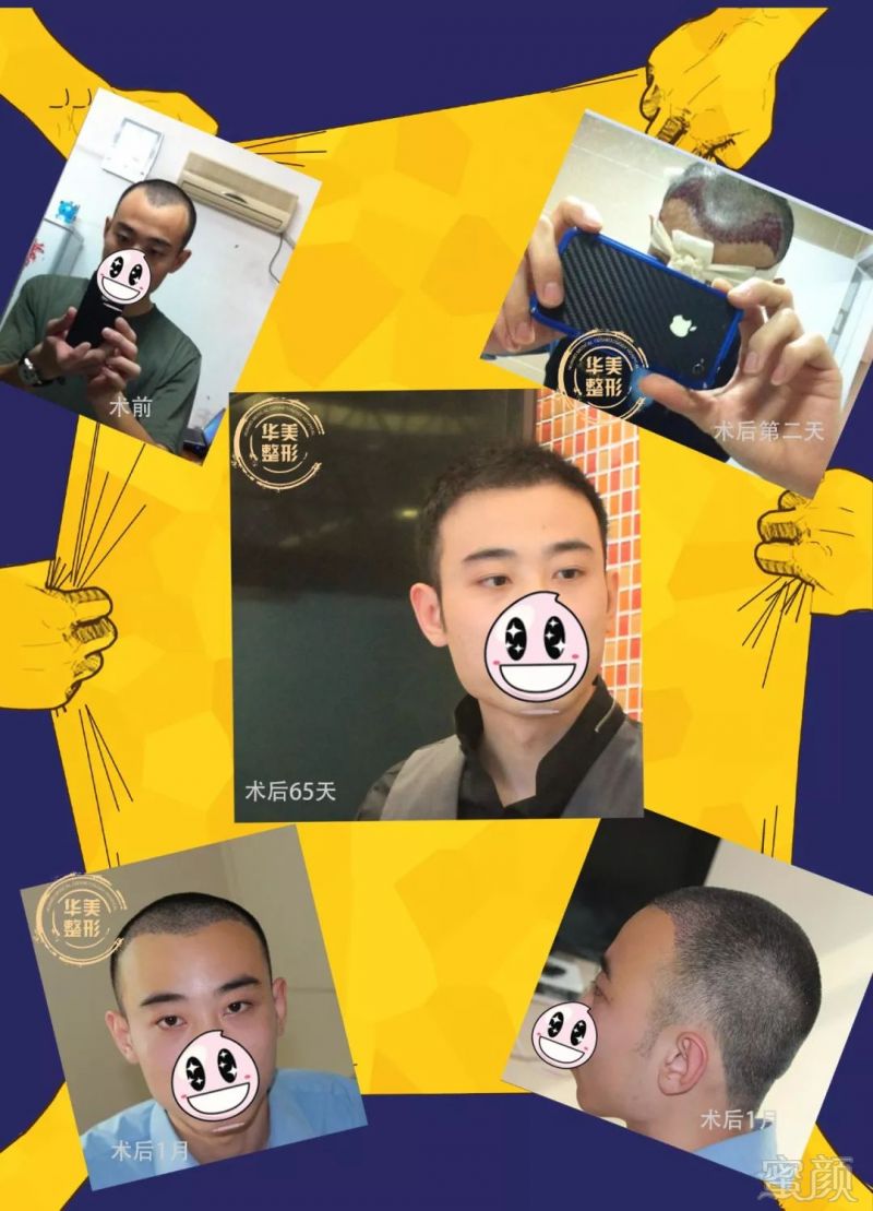https://img.miyanlife.com/mnt/timg/180416/1100343K8-0.jpg