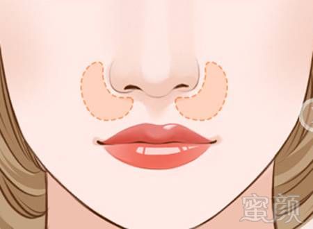 https://img.miyanlife.com/mnt/timg/180416/111443L34-0.jpg