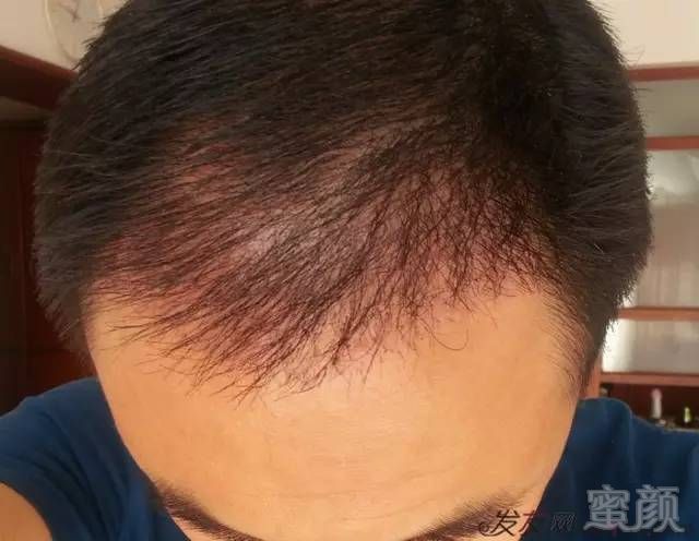 https://img.miyanlife.com/mnt/timg/180417/10451235I-4.jpg