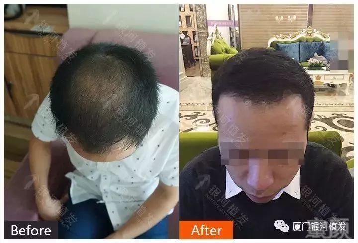 https://img.miyanlife.com/mnt/timg/180418/103J941V-3.jpg
