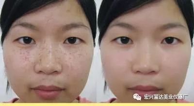 https://img.miyanlife.com/mnt/timg/180418/1102464H2-1.jpg
