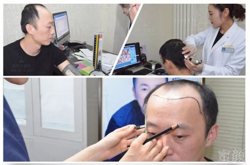 https://img.miyanlife.com/mnt/timg/180418/1203443424-10.jpg