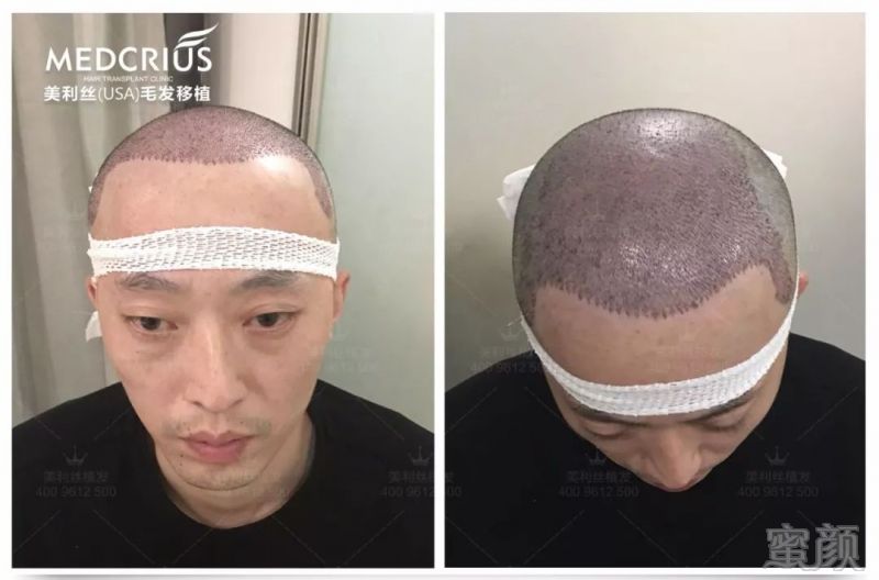 https://img.miyanlife.com/mnt/timg/180418/12034L3b-12.jpg
