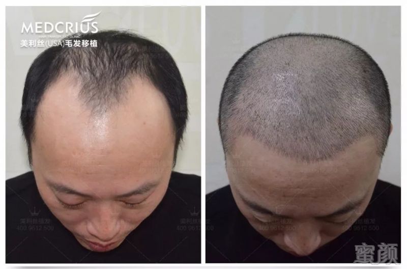https://img.miyanlife.com/mnt/timg/180418/12034TW4-13.jpg