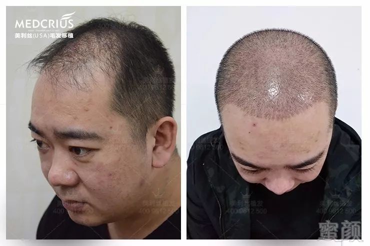 https://img.miyanlife.com/mnt/timg/180418/1203506463-14.jpg