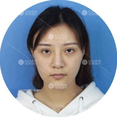 https://img.miyanlife.com/mnt/timg/180418/12215T1B-0.jpg