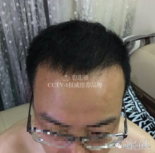 https://img.miyanlife.com/mnt/timg/180418/1223324144-6.jpg