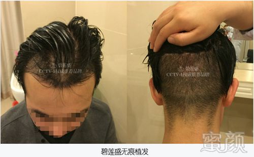 https://img.miyanlife.com/mnt/timg/180418/122359AY-0.jpg