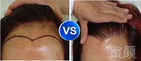 https://img.miyanlife.com/mnt/timg/180418/122AW952-9.jpg