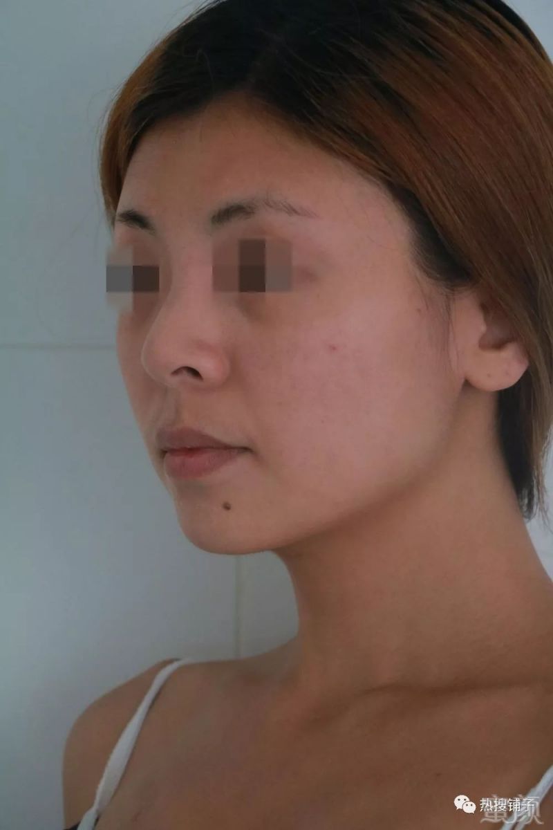 https://img.miyanlife.com/mnt/timg/180418/12514464C-1.jpg