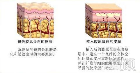 案例图片