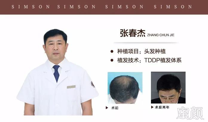 https://img.miyanlife.com/mnt/timg/180419/12333I353-13.jpg