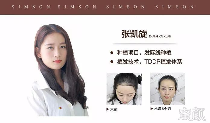 https://img.miyanlife.com/mnt/timg/180419/12333LK5-14.jpg