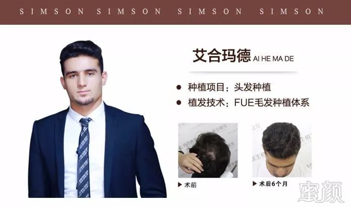 https://img.miyanlife.com/mnt/timg/180419/12333T3B-15.jpg