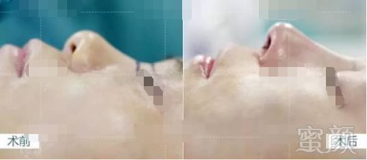 https://img.miyanlife.com/mnt/timg/180419/12501T435-9.jpg