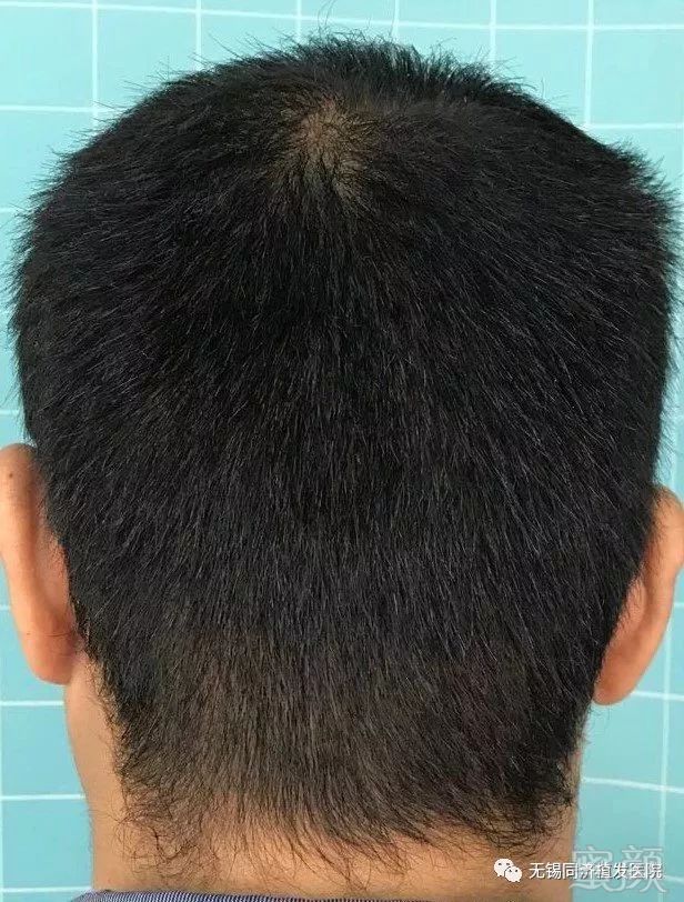 https://img.miyanlife.com/mnt/timg/180420/11334TZ9-2.jpg