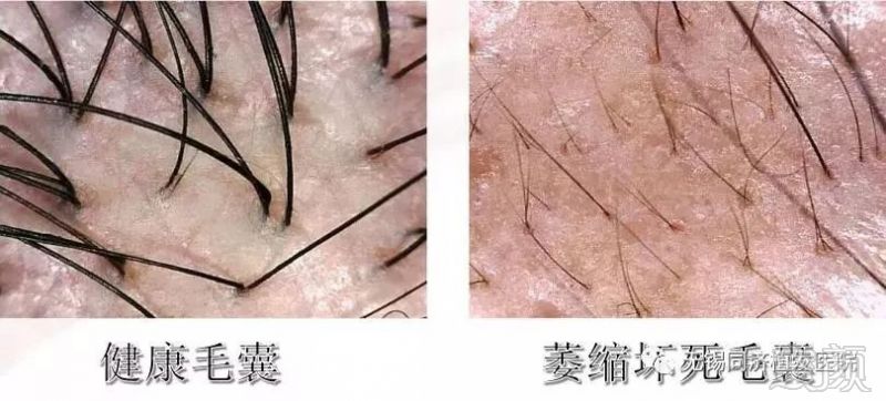 https://img.miyanlife.com/mnt/timg/180420/11334V2C-3.jpg