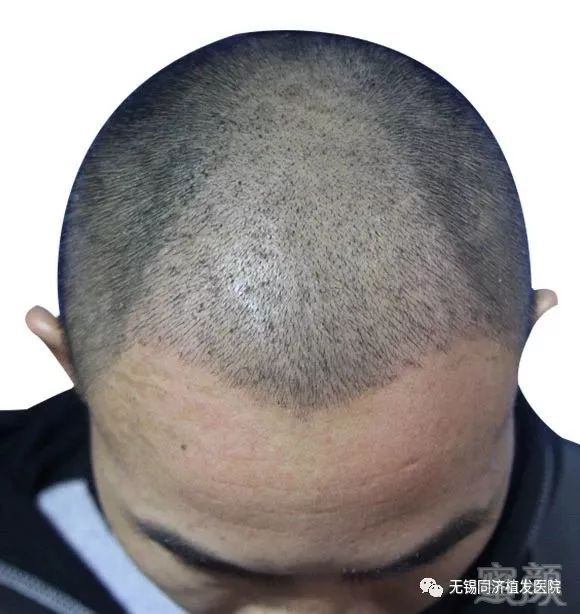 https://img.miyanlife.com/mnt/timg/180420/1133524K6-9.jpg