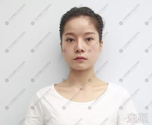 https://img.miyanlife.com/mnt/timg/180420/114H14313-3.jpg