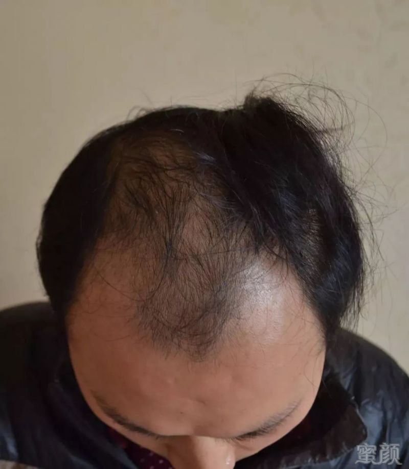 https://img.miyanlife.com/mnt/timg/180420/12030G323-2.jpg
