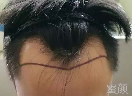 https://img.miyanlife.com/mnt/timg/180420/120311E04-8.jpg