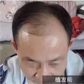 https://img.miyanlife.com/mnt/timg/180420/1203125R4-13.jpg