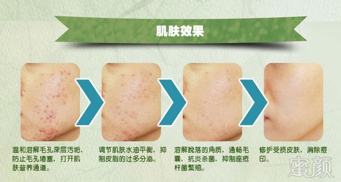 https://img.miyanlife.com/mnt/timg/180420/1213433243-2.jpg