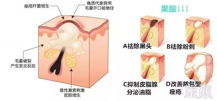 https://img.miyanlife.com/mnt/timg/180420/12134442b-4.jpg