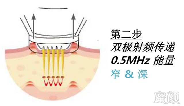 案例图片