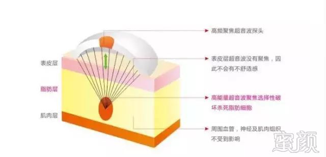 案例图片