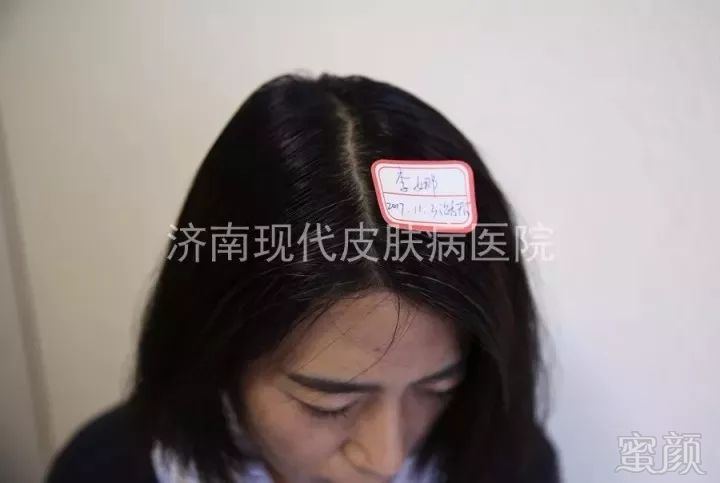 https://img.miyanlife.com/mnt/timg/180422/13000CK9-6.jpg