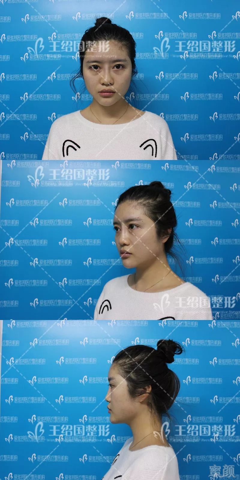 https://img.miyanlife.com/mnt/timg/180422/13124912K-4.jpg