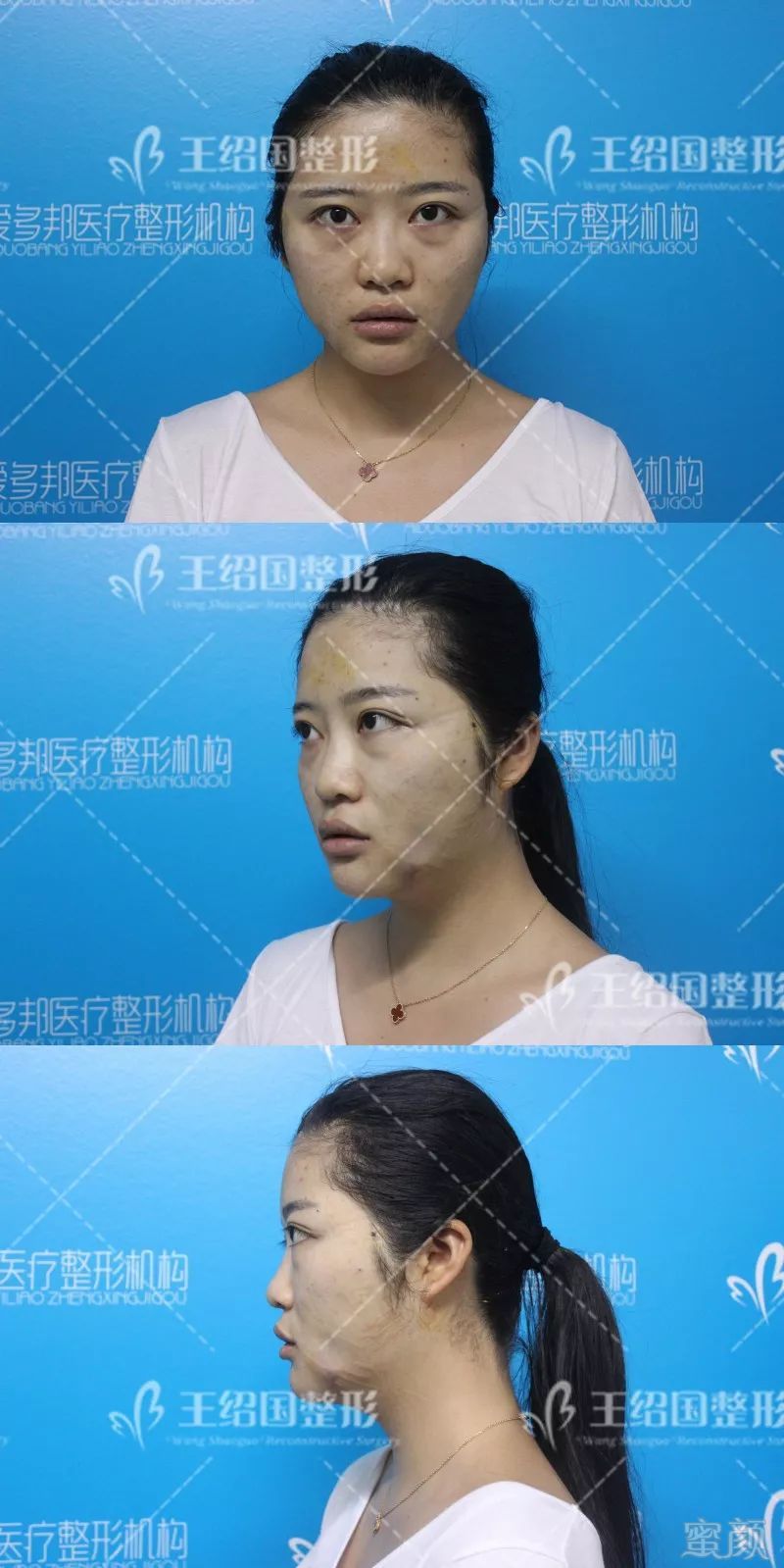 https://img.miyanlife.com/mnt/timg/180422/13124W595-2.jpg