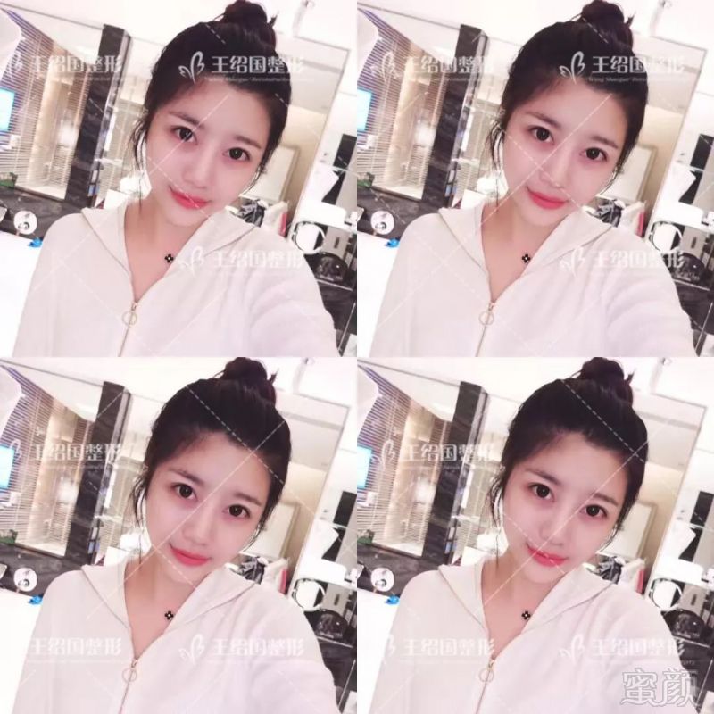 https://img.miyanlife.com/mnt/timg/180422/1312524934-6.jpg