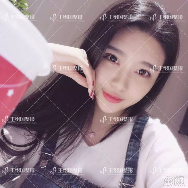 https://img.miyanlife.com/mnt/timg/180422/13125331Q-7.jpg