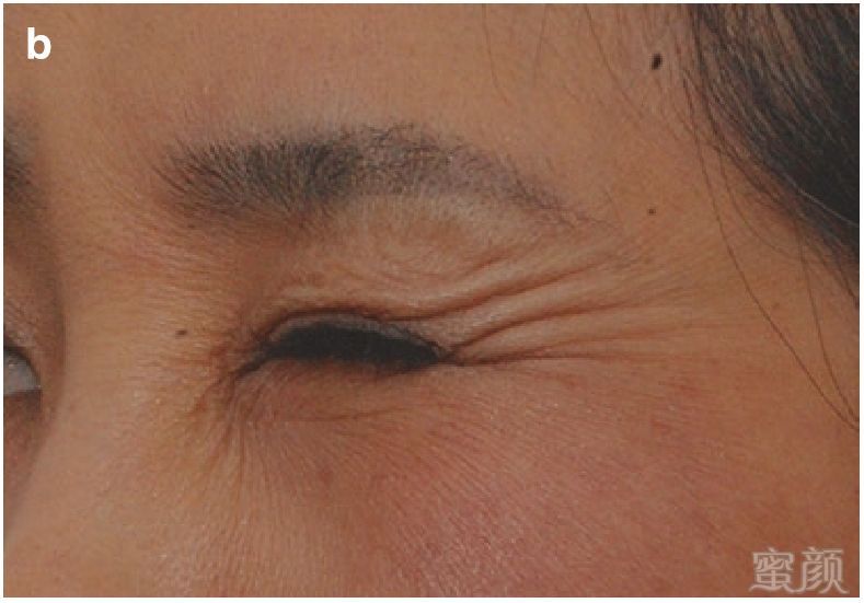 https://img.miyanlife.com/mnt/timg/180423/1023102527-4.jpg