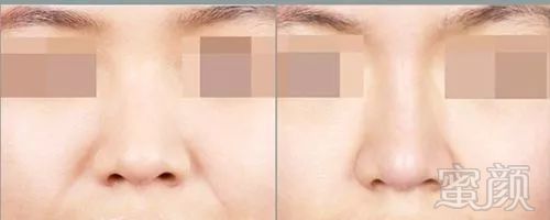 https://img.miyanlife.com/mnt/timg/180423/103A35U9-5.jpg